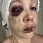 Novas fotos estão mostrando grandes perigos das mulheres após a duração de Cincininninninni Brawl