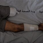 Gaza, a morte parece mais fácil do que cortar